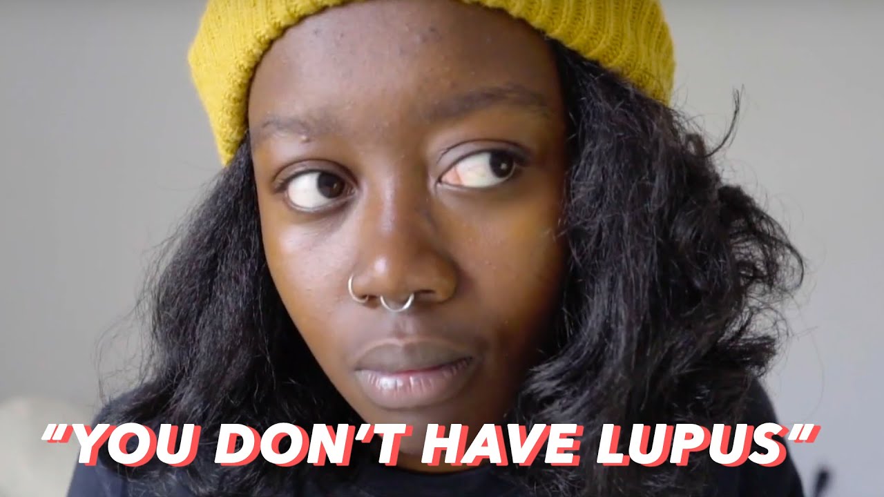 She Told Me I Didn't Have Lupus - Diagnosed With A Chronic Illness
