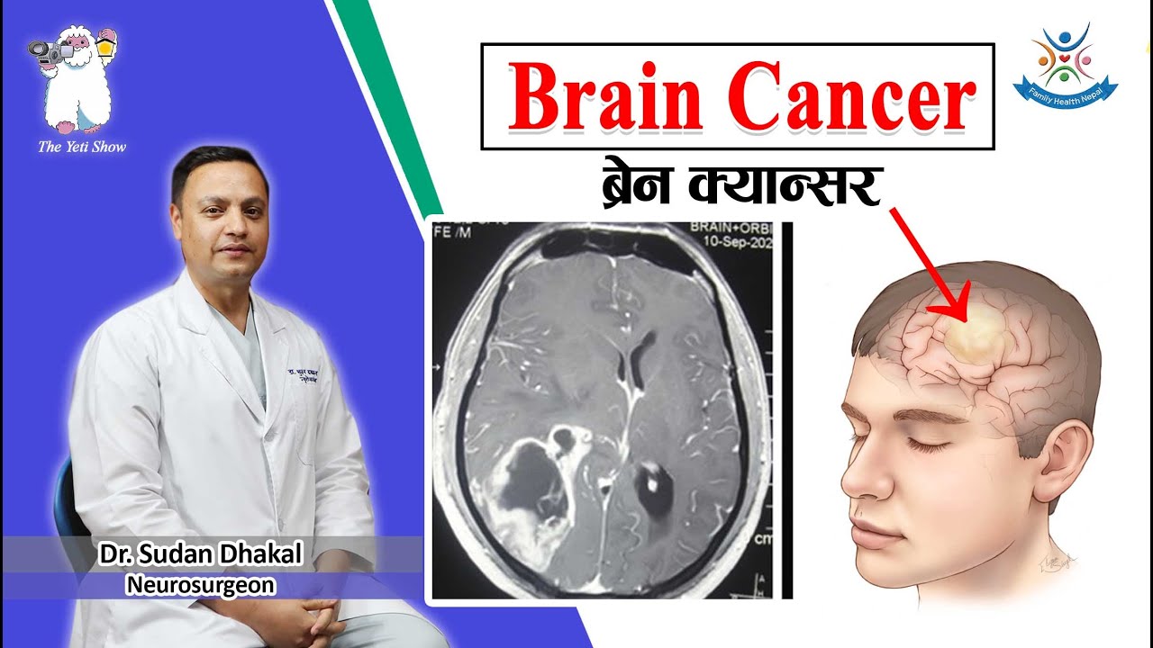 Brain Cancer (ब्रेन क्यान्सर)  Types, Symptoms, Diagnosis & Treatment (Annapurna Neuro Hospital)