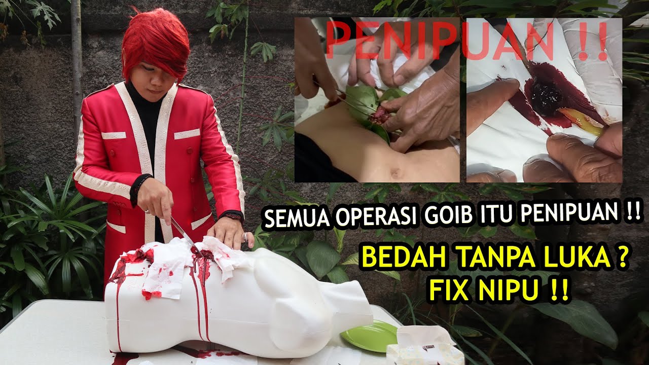 PLEASE KASIH TAU KELUARGAMU ‼️ SEMUA OPERASI GOIB ITU PENIPUAN ‼️ RAHASIA BEDAH TANPA LUKA