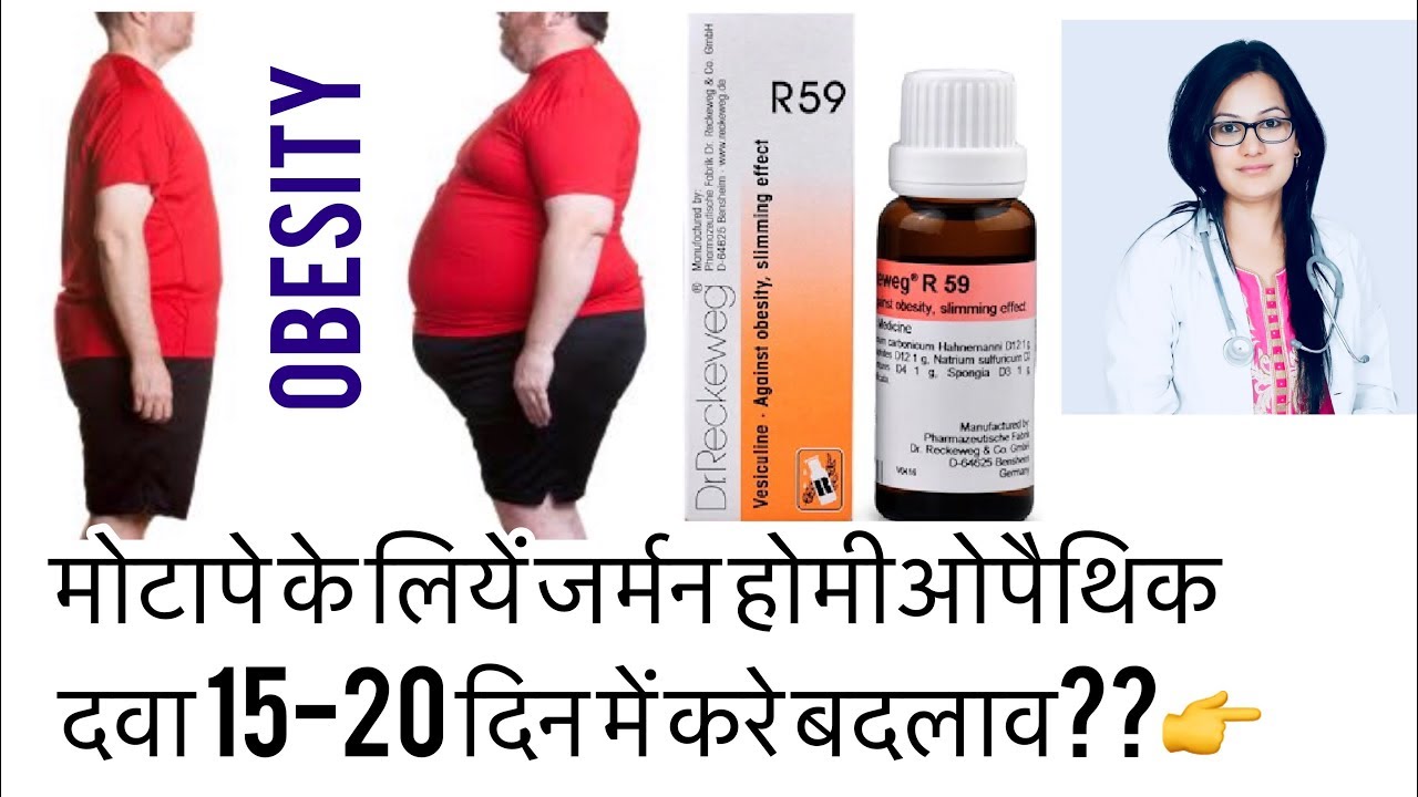 Obesity Best Homeopathic Medicine ?मोटापेसेपरेशान??बेस्ट होमीओपैथिक Treatment-डॉक्टर रुक्मणी चौधरी