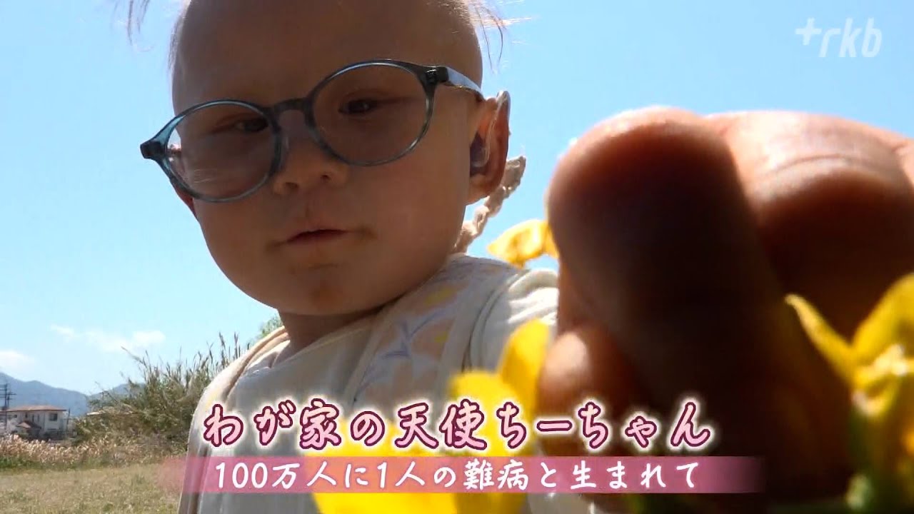 『わが家の天使ちーちゃん100万人に1人の難病と生まれて』