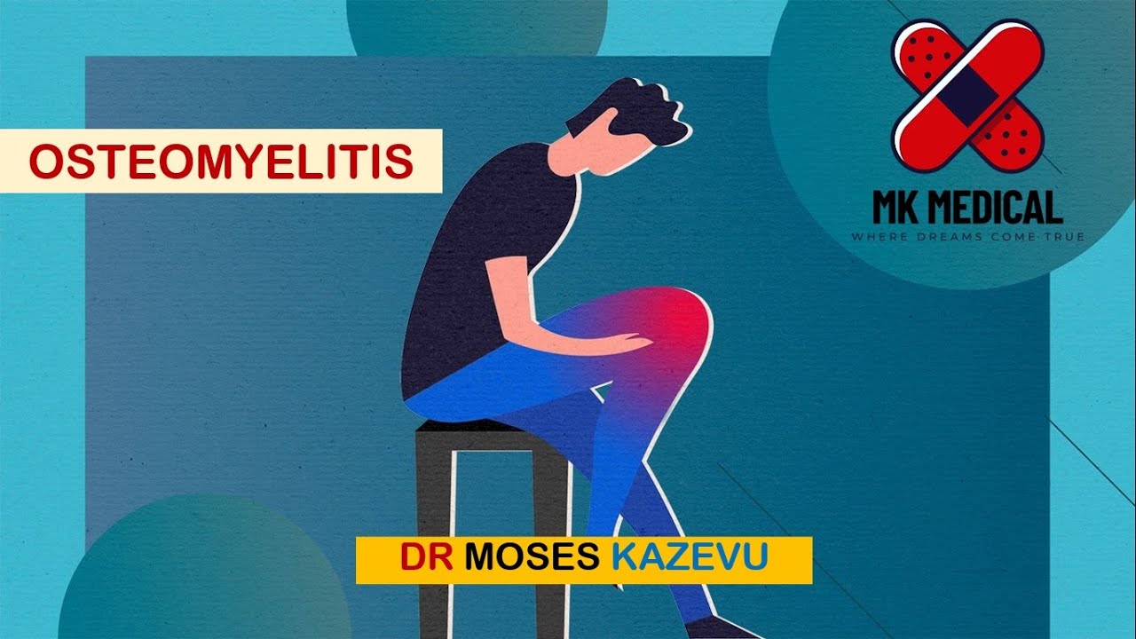 Остеомиелит