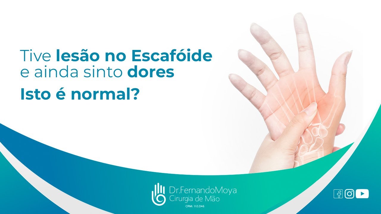 Tive lesão no Escafóide e ainda sinto dores. Isto é normal? | Dr. Fernando Moya CRM 112046