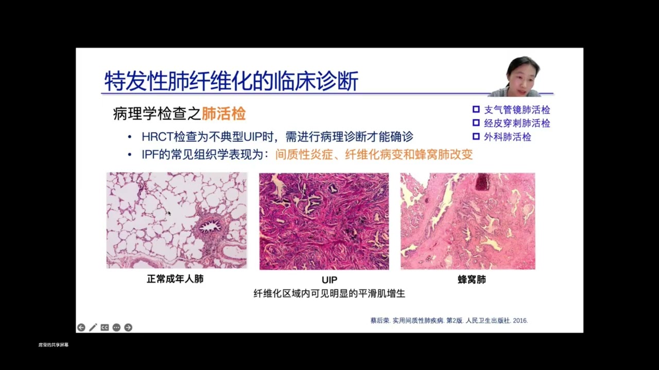 我们说 Women Talk 第44讲｜席莹说：解密呼吸困难背后的肺纤维化真相（报告环节）