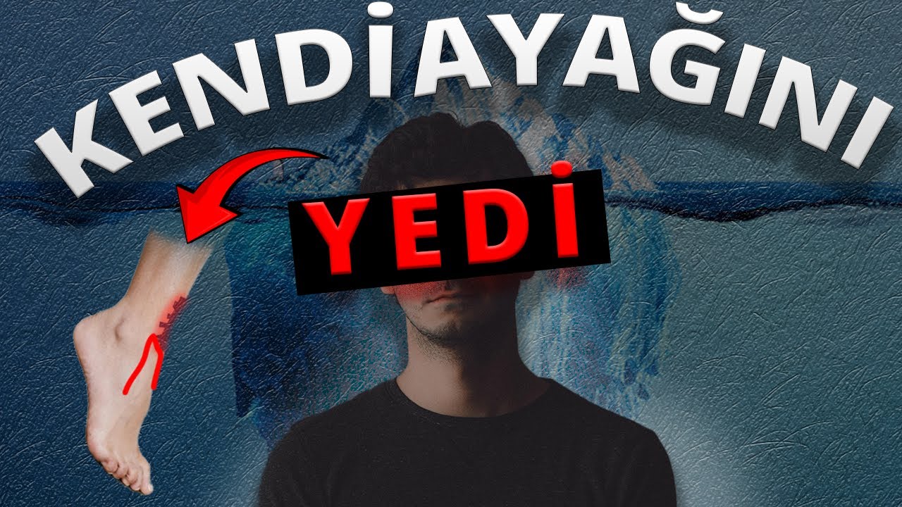 RAHATSIZ EDİCİ REDDİT POSTLARI BUZDAĞI
