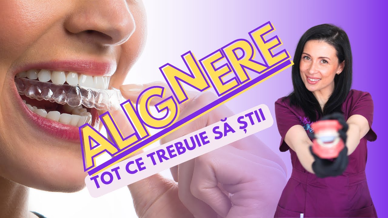 ALIGNERE: Tot ce trebuie să știi