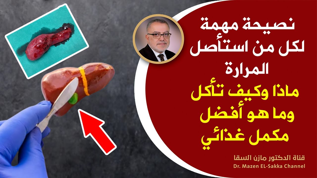 نصيحة مهمة بعد عملية المرارة | نصائح بعد استئصال المرارة | ماذا وكيف تأكل وما هو أفضل مكمل غذائي