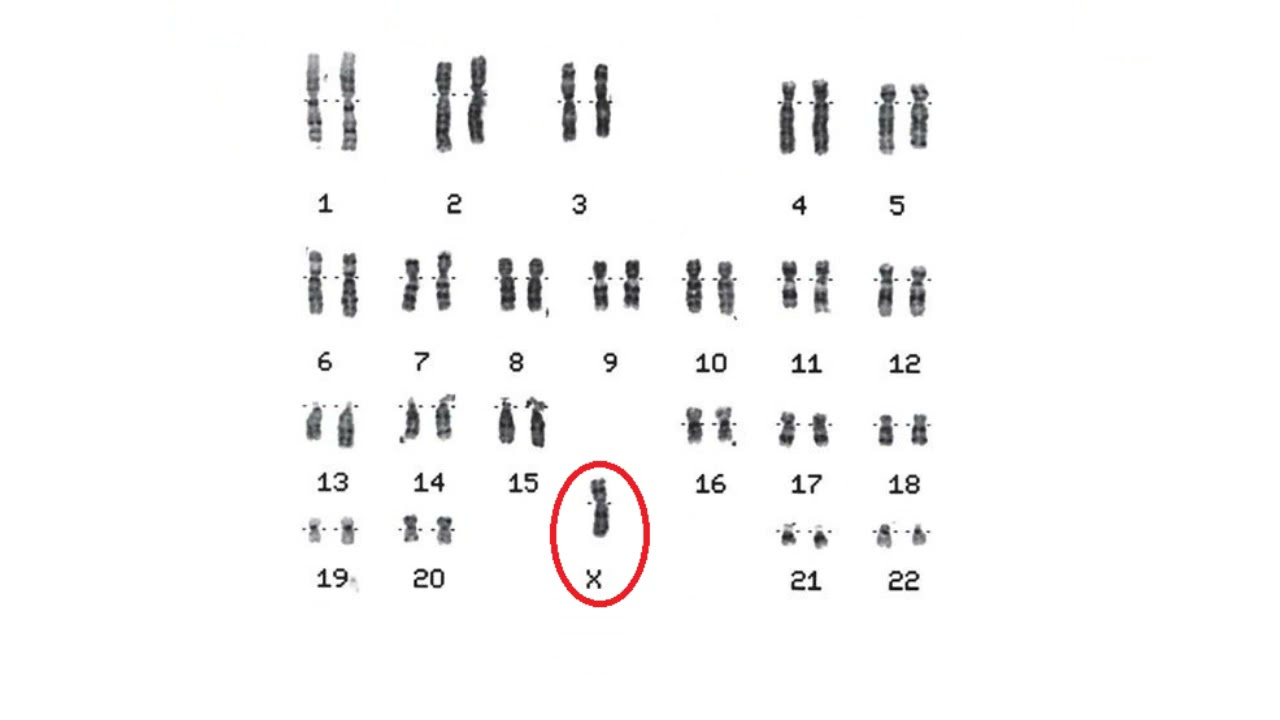 Chromosome Analysis