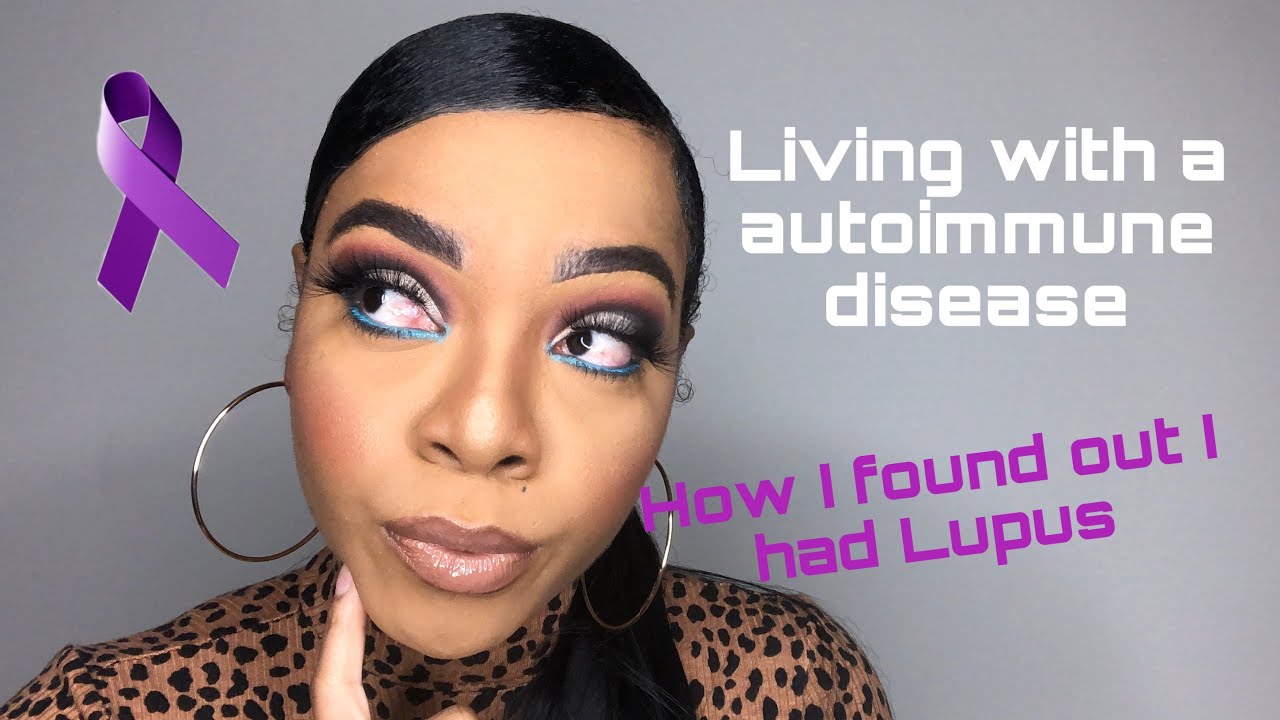 My Lupus Journey| How I found out I have Lupus| living with a autoimmune disease!