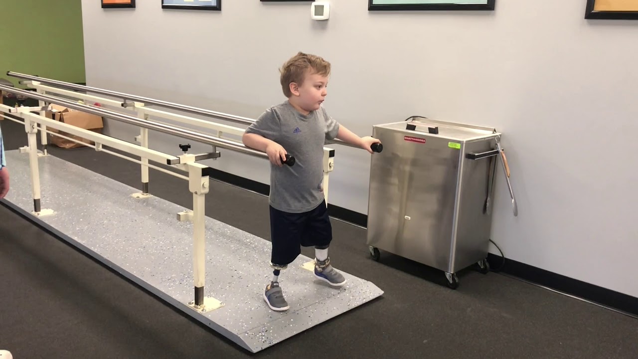 Bilateral BK Congenital Amputee