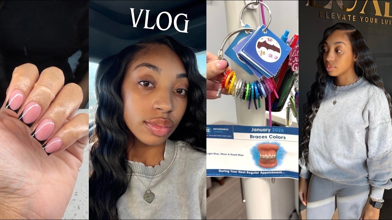 VLOG | 3 Month Braces Update + Maintenance