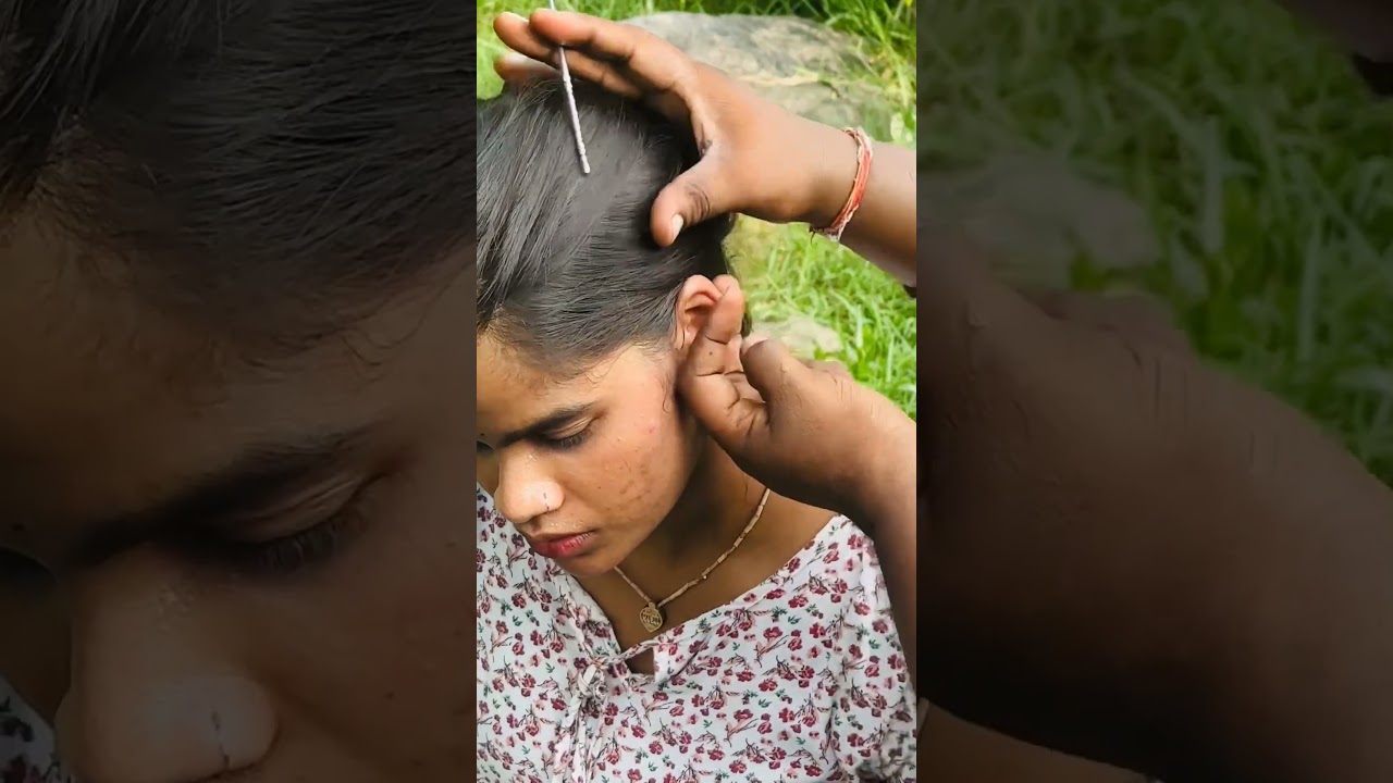 Deep Ear😱😱😱😱 Wax REMOVAL Watch Full video#asmr#shorts#earwaxremoval#earwax