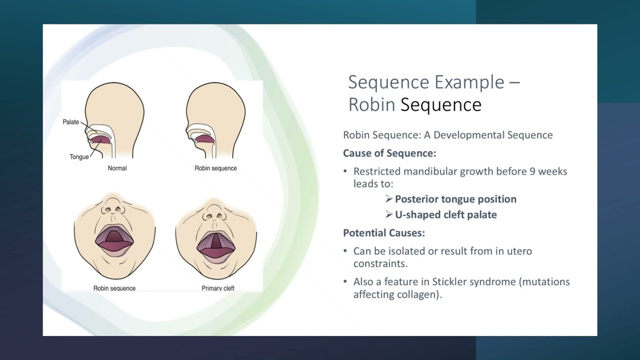Lecture 20 Chp15 Developmental Genetics and Birth Defects Part 1