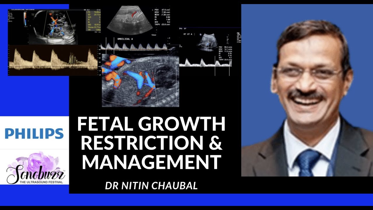 NITIN CHAUBAL | FETAL GROWTH RESTRICTION & MANAGEMENT | PHILIPS WORKSHOP | SONOBUZZ VIRTUAL