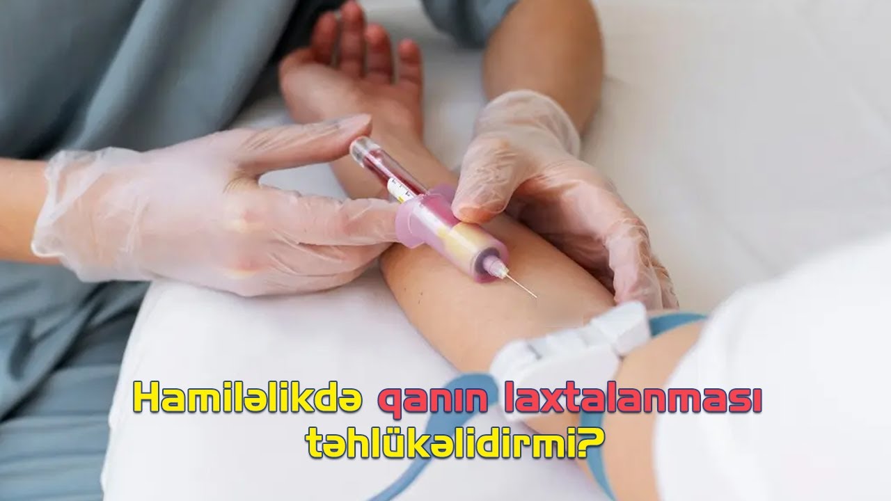 Hamiləlikdə qanın laxtalanması təhlükəlidirmi? - mama - ginekoloq uzman dr. Aynurə Nəcəfəliyeva