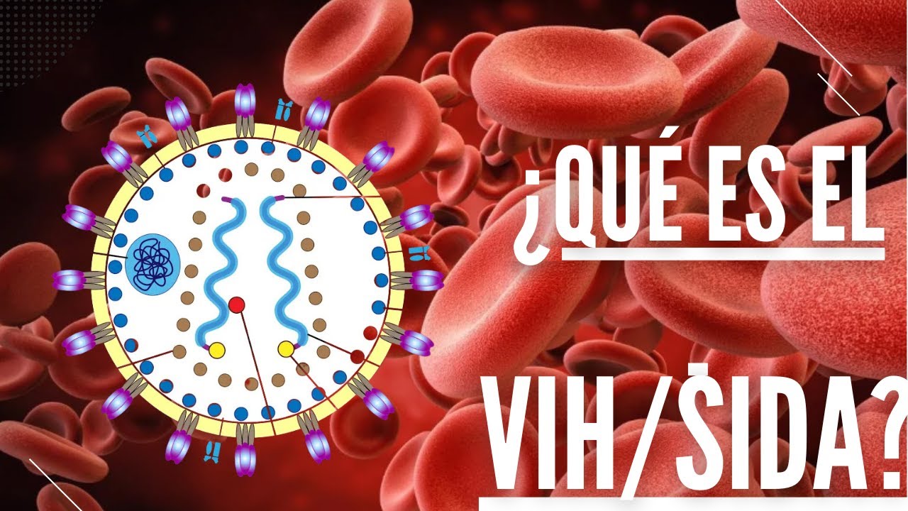¿Qué es el VIH/SIDA?