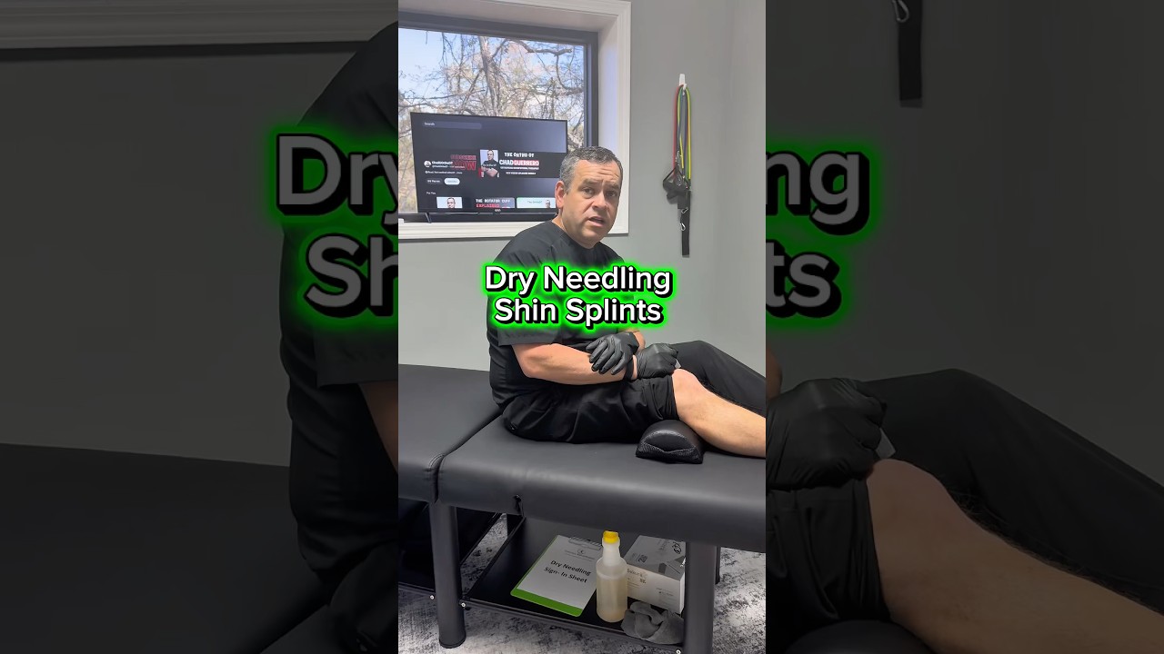 Dry Needling For Shin Splints(Tib Anterior Muscle)