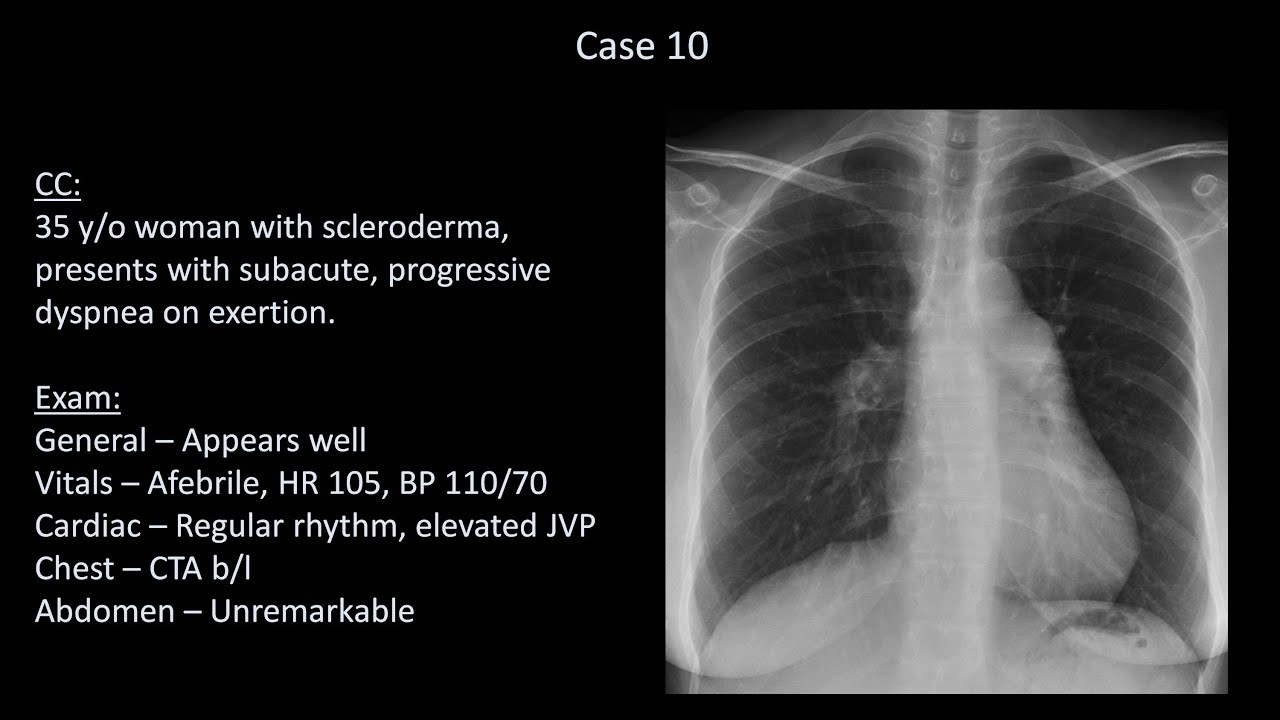 How to Interpret a Chest X-Ray (Lesson 10 - Self Assessment): Part 2