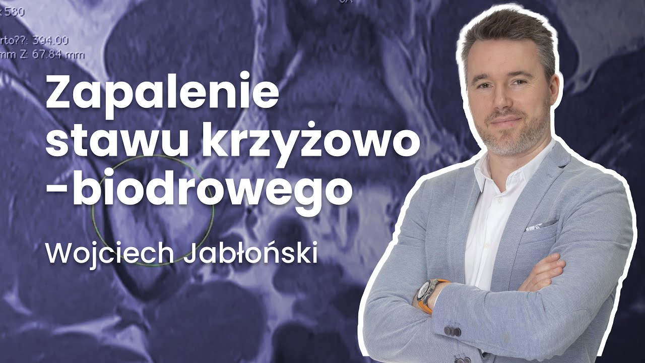 Zapalenie stawu krzyżowo-biodrowego | #16 Radiologia