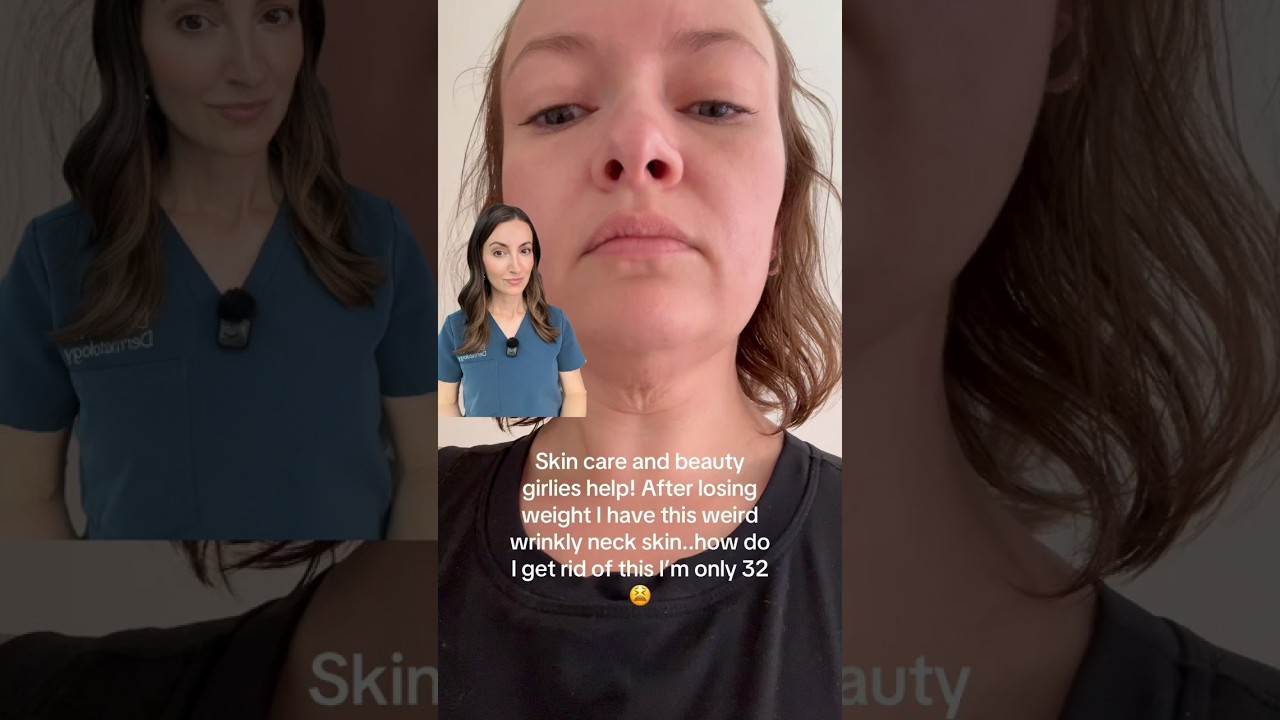 Noticing a little sagging in your neck now that you&rsquo;re in your 30s &mdash; especially after weight loss?