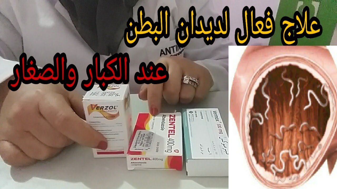 علاج فعال لديدان البطن عند الكبار والصغار