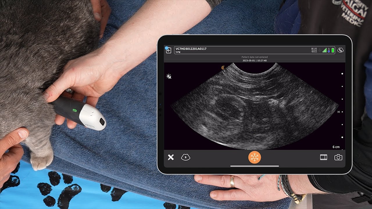 Pleural Space and Lung Scanning