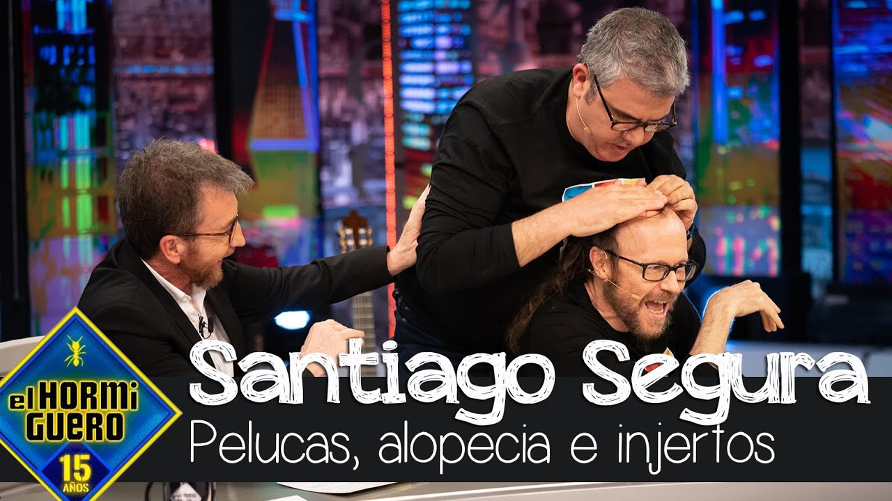 Santiago Segura habla de pelucas, alopecia e injertos ¿Se ha planteado ir a Turquía? - El Hormiguero
