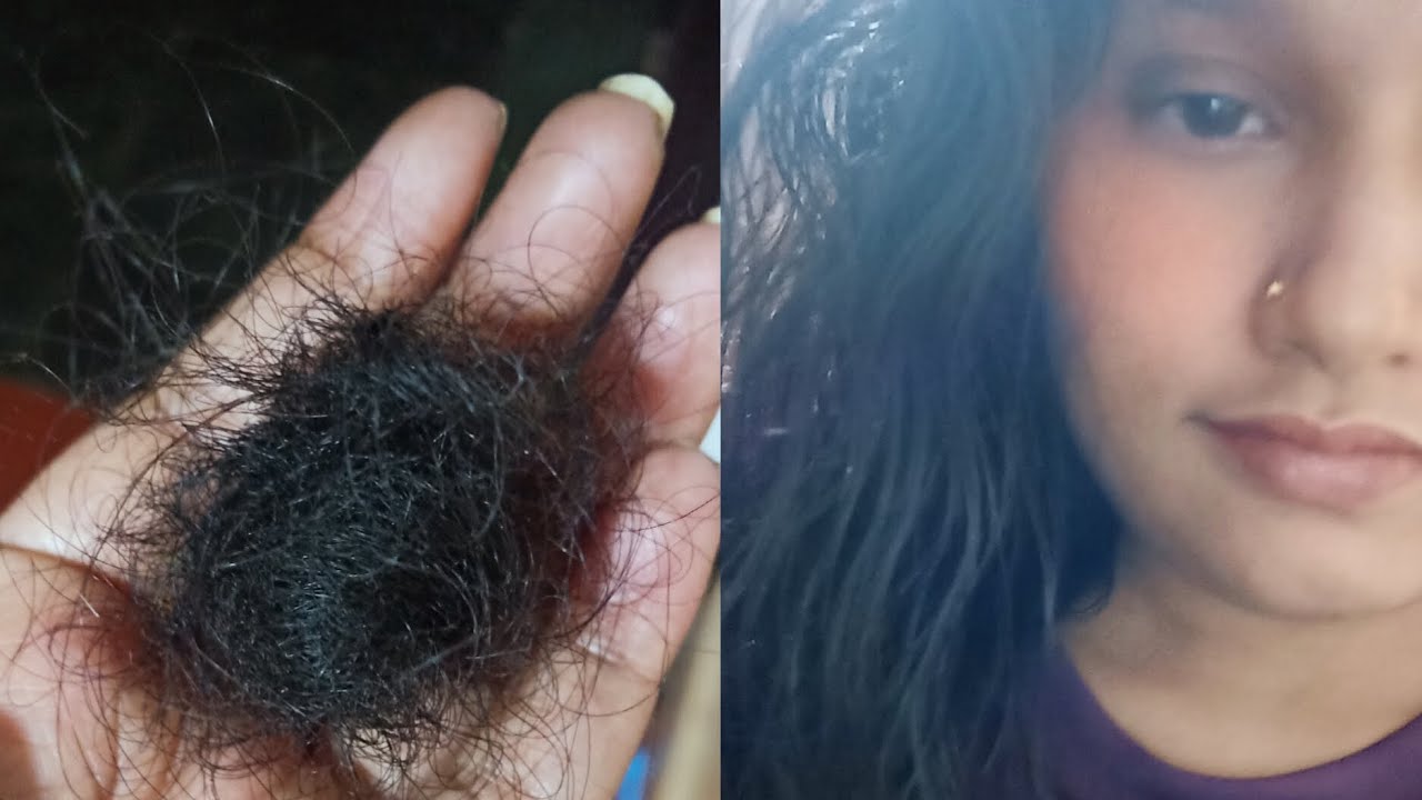 Understanding Vitamin D Deficiency: Causes, symptoms, and the best treatment plans.