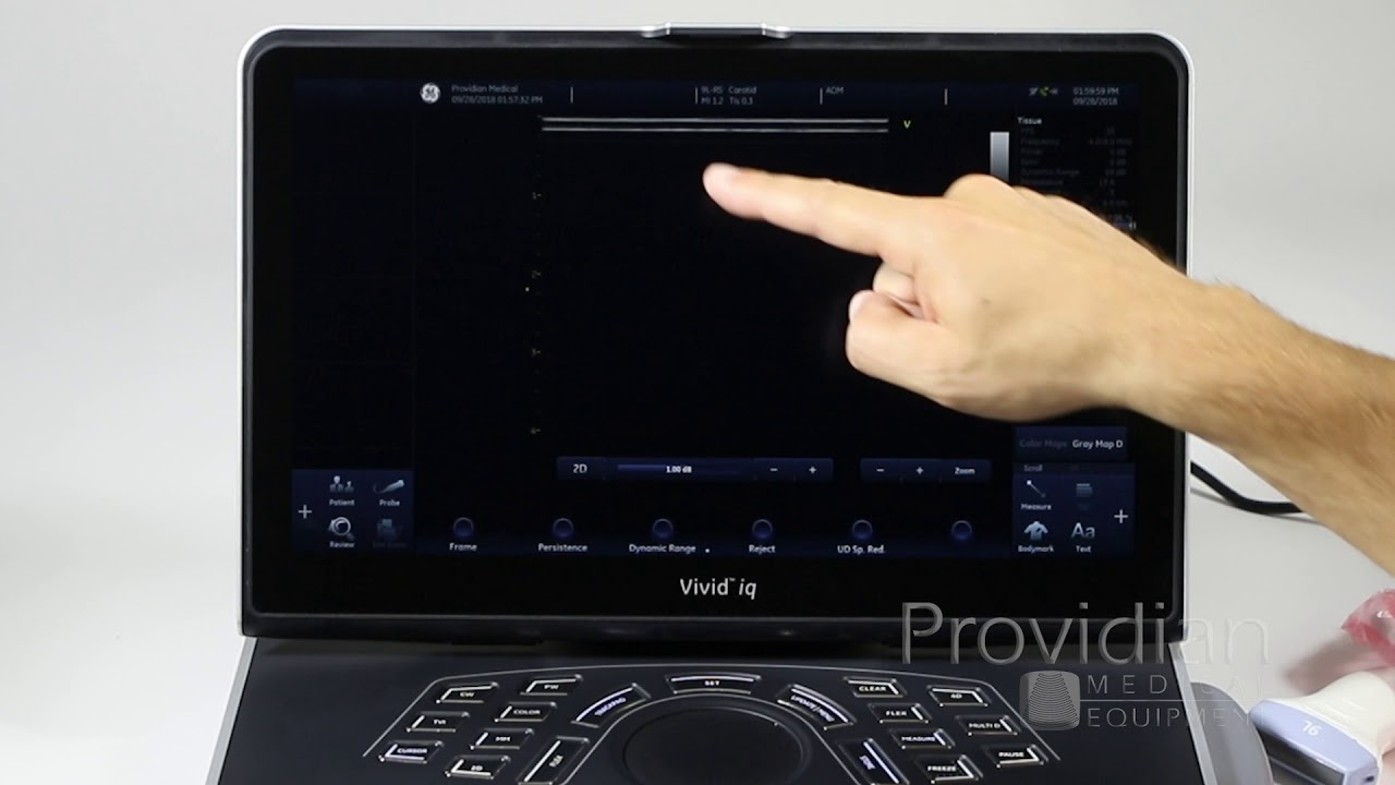 GE Vivid iq Training Part 1: Understanding and Using the New Interface