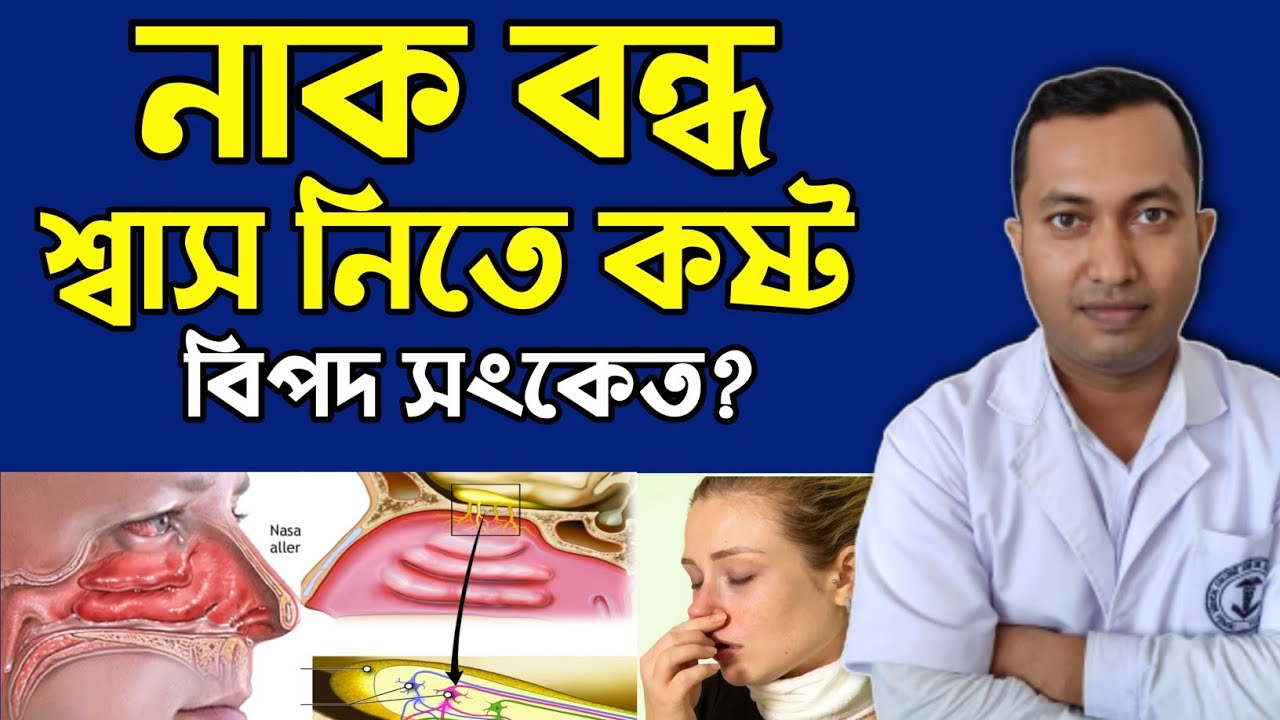 নাকবদ্ধ থাকা,শ্বাস নিতে কষ্ট সর্দি কাশি সমস্যা নাকের এলার্জি বিপদ সংকেত? নাকের এলার্জি থেকে মুক্তি |