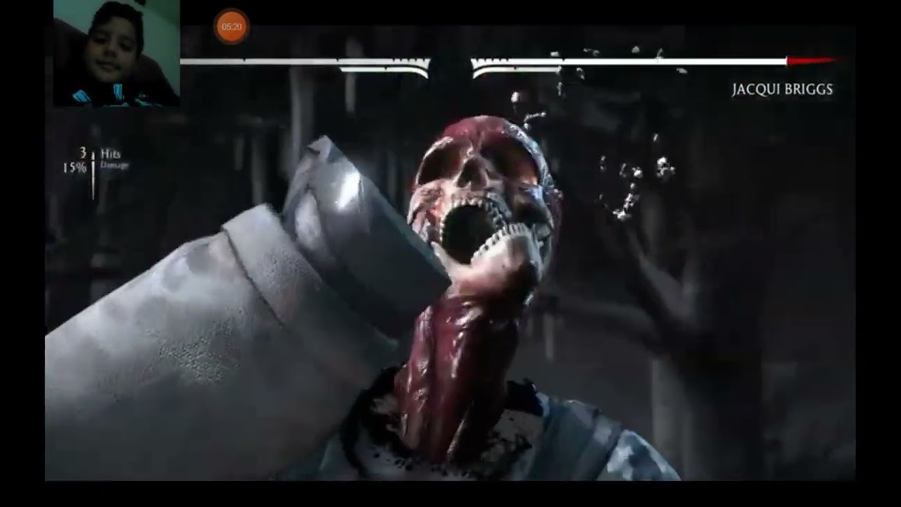 relacionando a x ray de mkxl