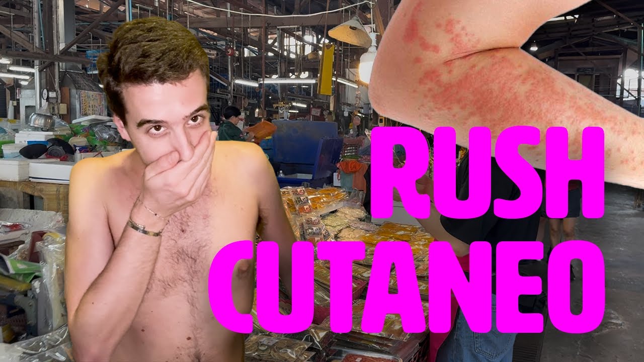 punture misteriose in Thailandia… 🐛 bed bugs o peggio?!