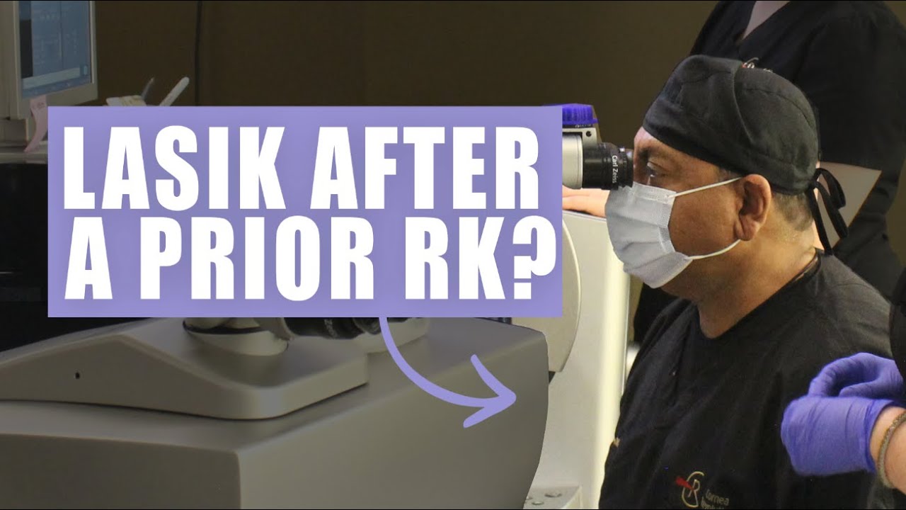 Thinking About Getting LASIK on a Prior RK?