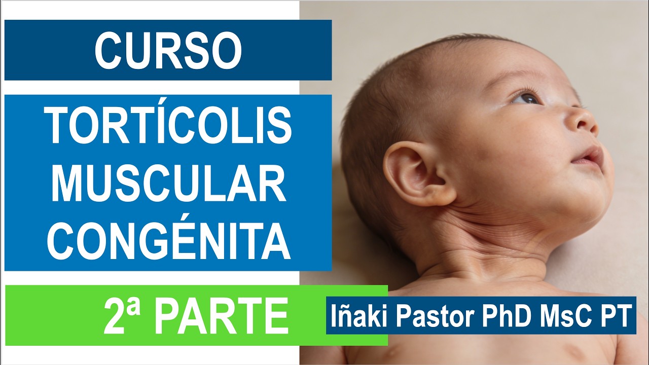 Curso de Tortícolis Muscular Congénita Parte 2