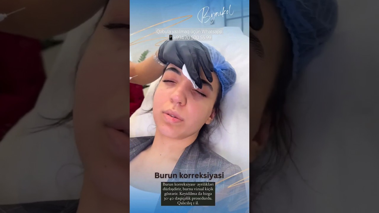Burun dolğusu korreksiyası #ByNikol #burun #burundolgusu