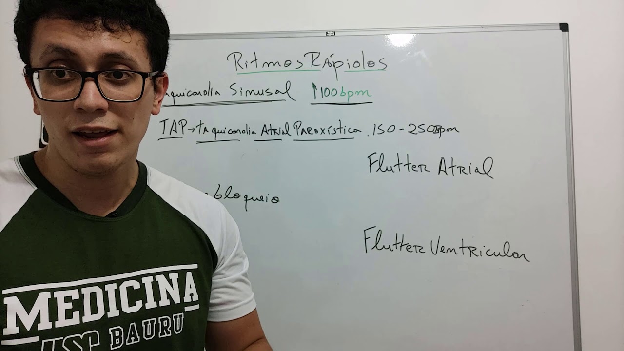 Interpreta&ccedil;&atilde;o de ECG( Extra s&iacute;stole e Ritmos acelerados )