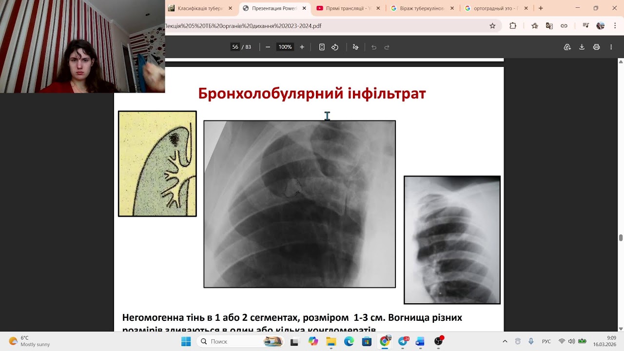 study with me № 441 16.03.2026) Фтизиатрия