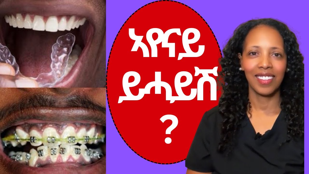 ኣፍልጦ ብዛዕባ ብረየስስ #Tigrina #Eritrea #Dental care