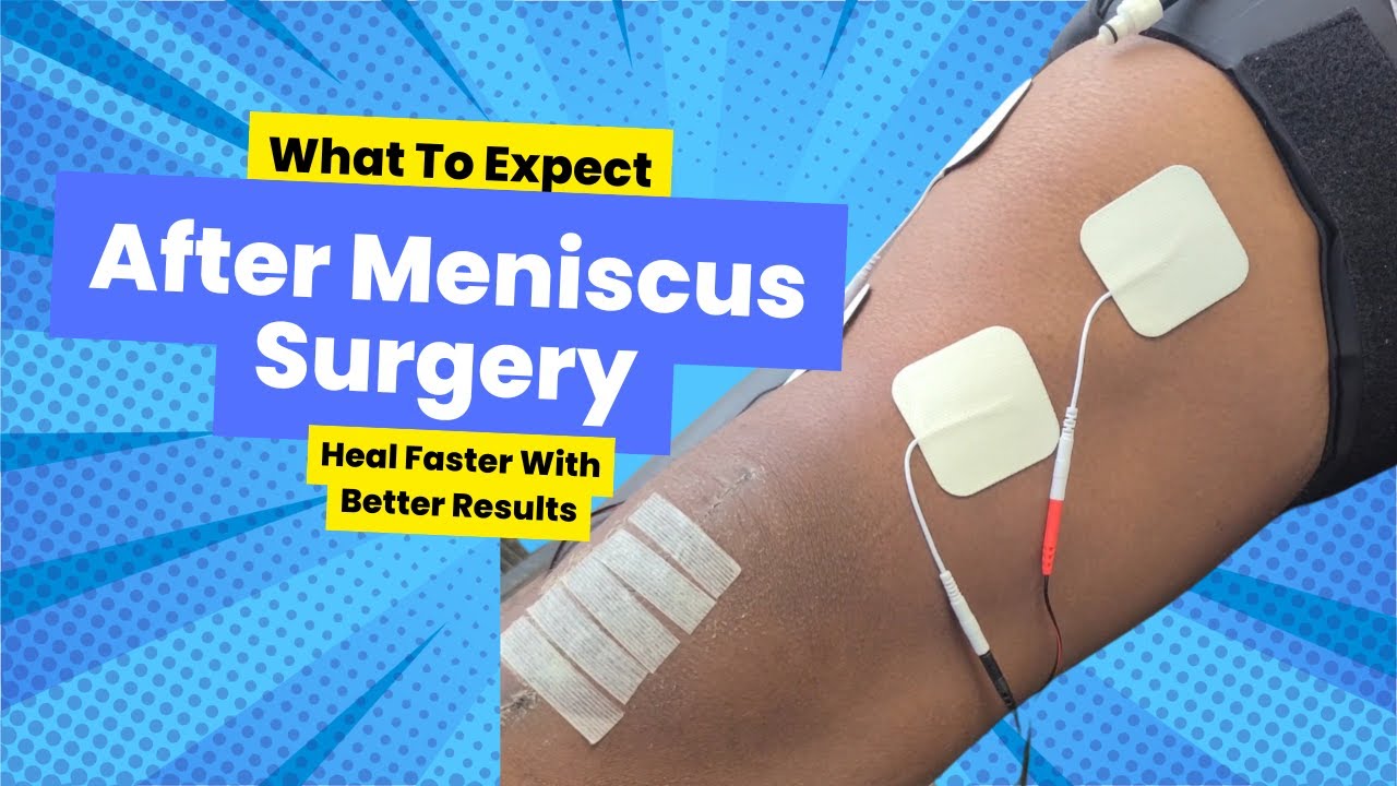 What To Expect After Meniscus Repair Surgery