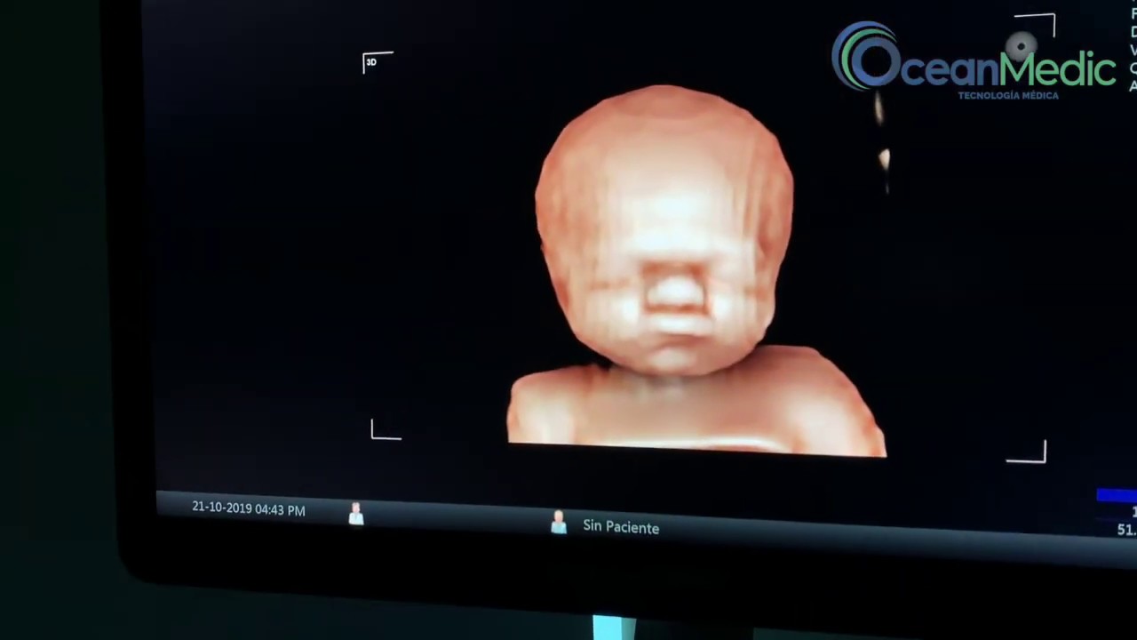 Funciones 3D/4D Vinno