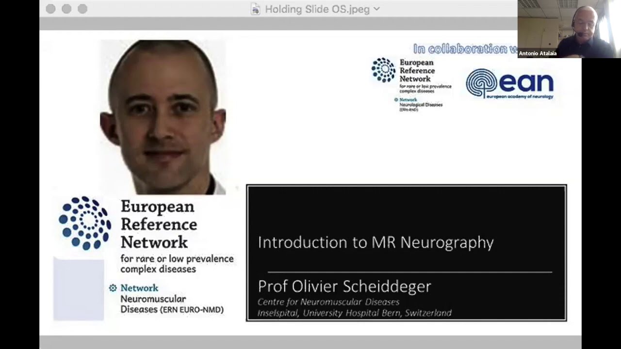 Introduction to MR Neurology delivered by Olivier Scheidegger.