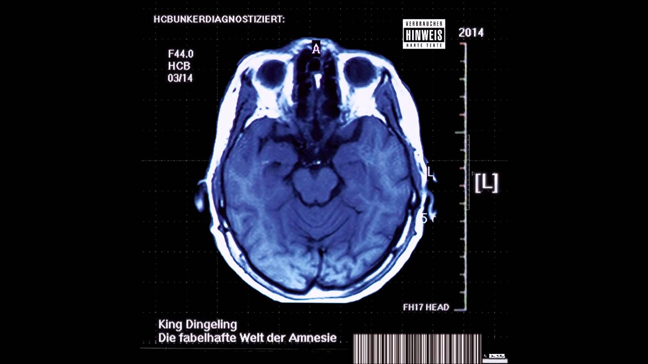 King Dingeling - Mr. Kater (Die Tote Katze 2.0) (feat. Diggla & Koleric) (2014) (Track 4)