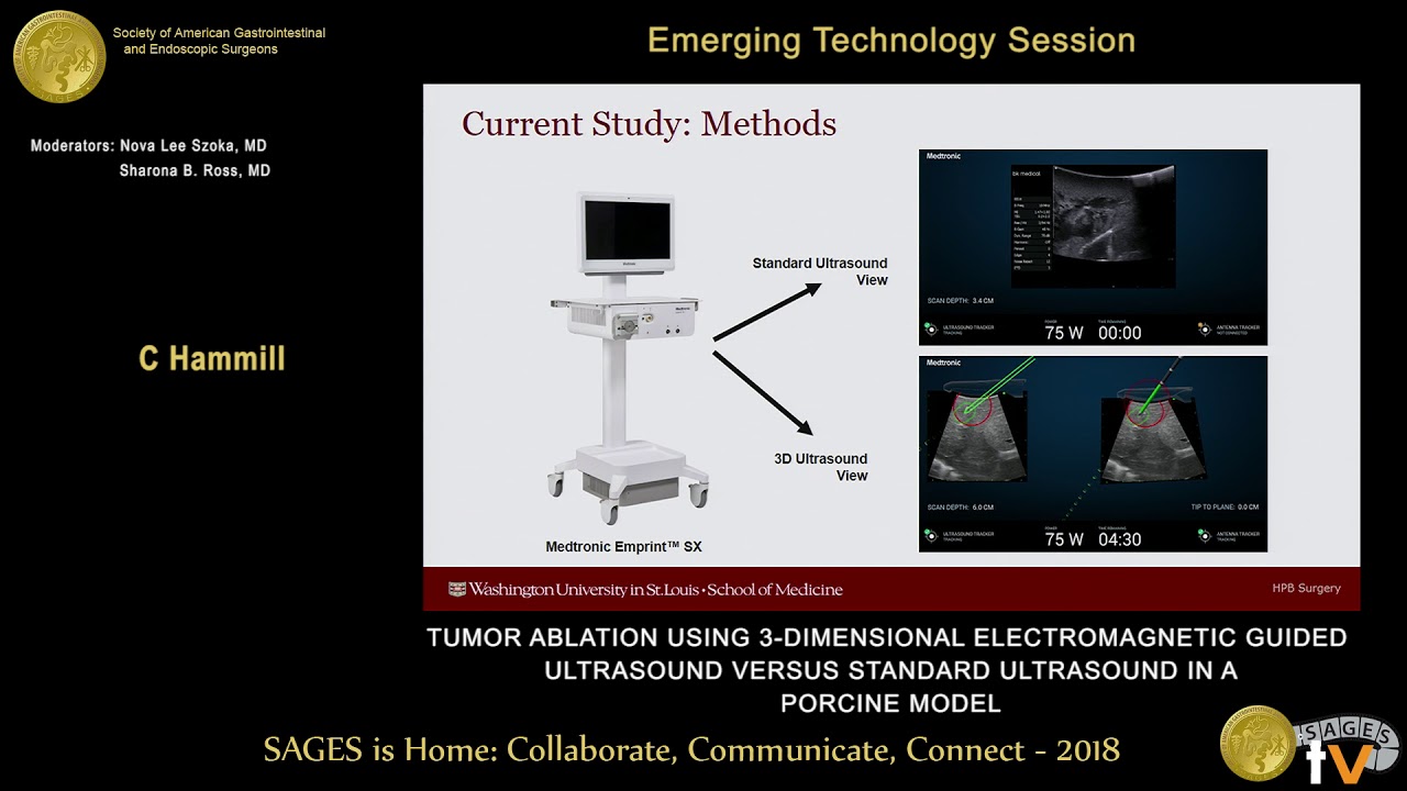 Tumor ablation using 3-D electromagnetic guided ultrasound vs standard ultrasound in a porcine model