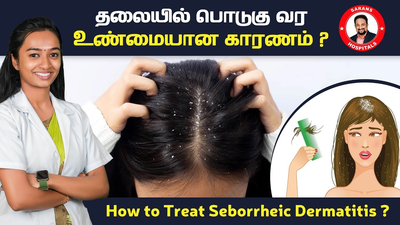 யாருக்கெல்லாம் பொடுகு (Dandruff) வரும் ? 4+ Natural Ways to Get Rid of Dandruff Quickly at Home
