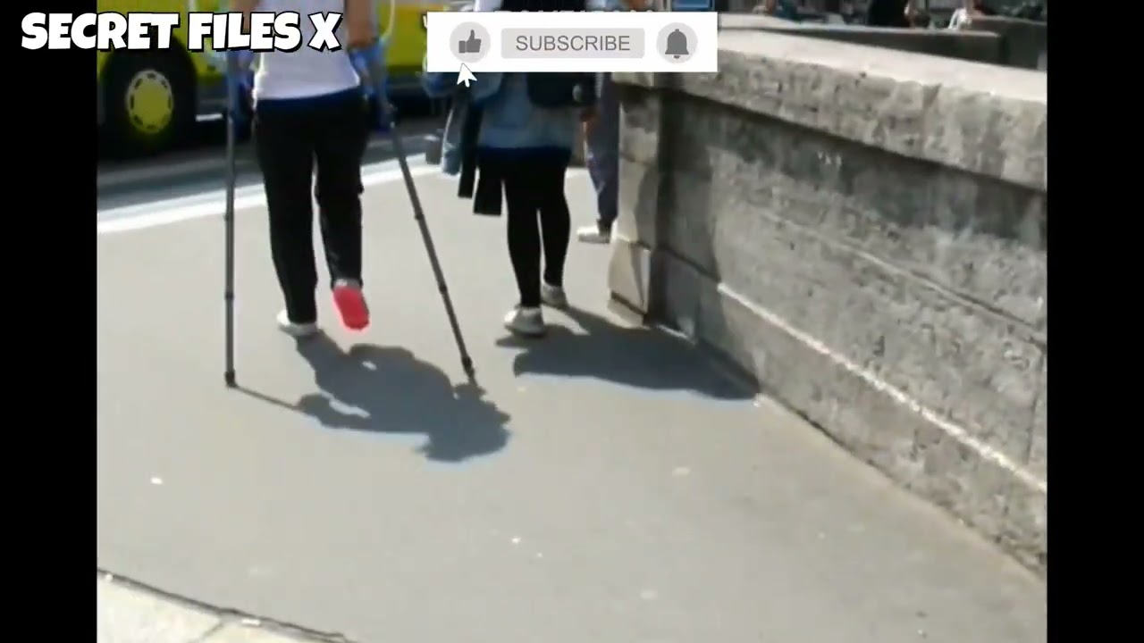 Clip 16 ‐ Nice Pink leg cast SLC, Broken leg