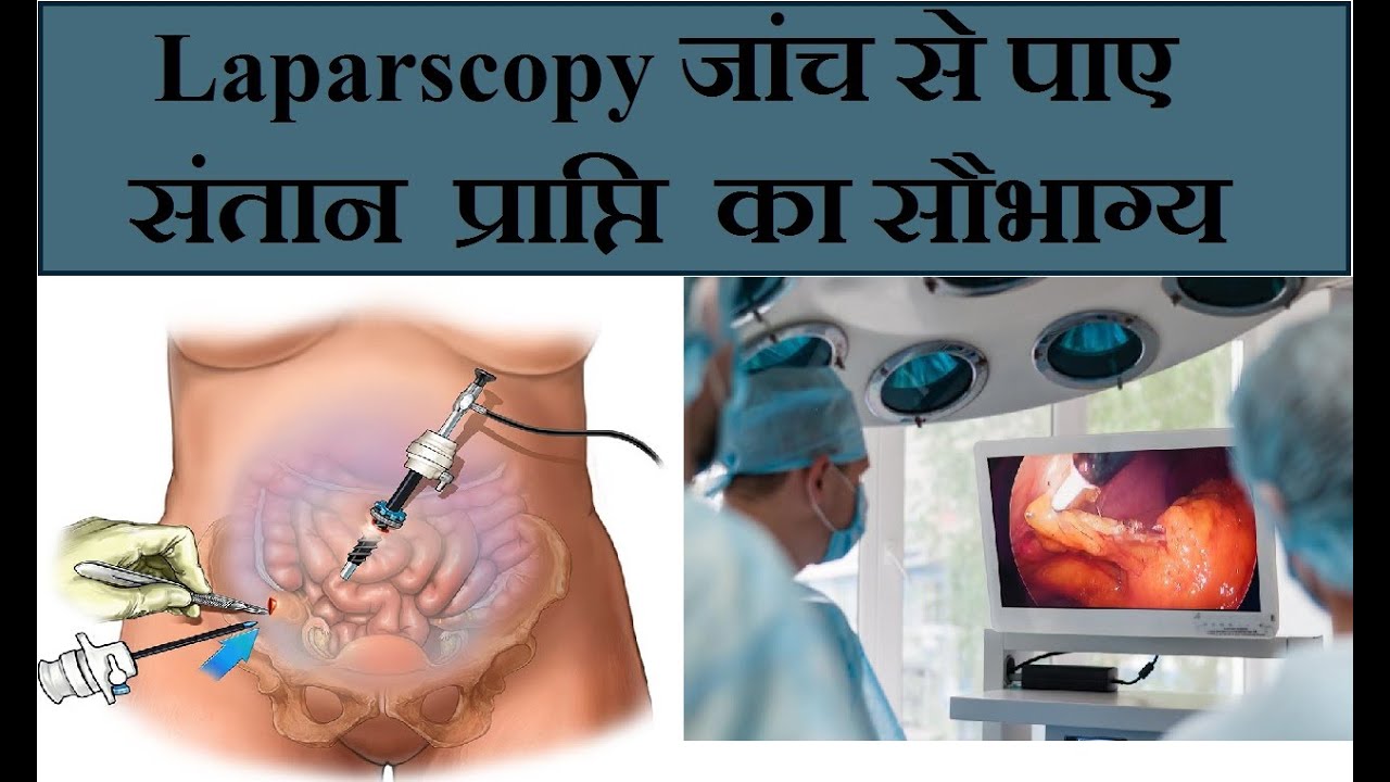 लैपरोस्कोपी से संतान प्राप्ति का सौभाग्य - Laparoscopy Hysteroscopy For Infertility