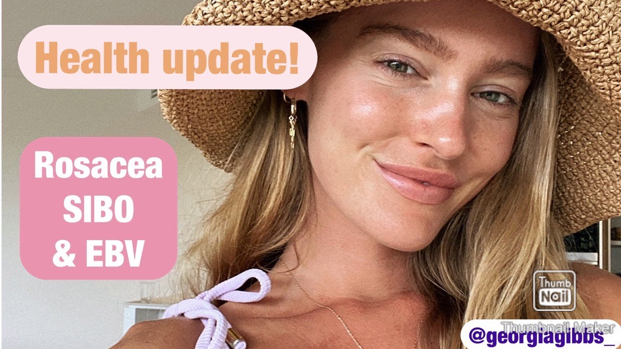 Health Update | Heal Rosacea, SIBO & beat Epstein Barr Virus | Georgia Gibbs