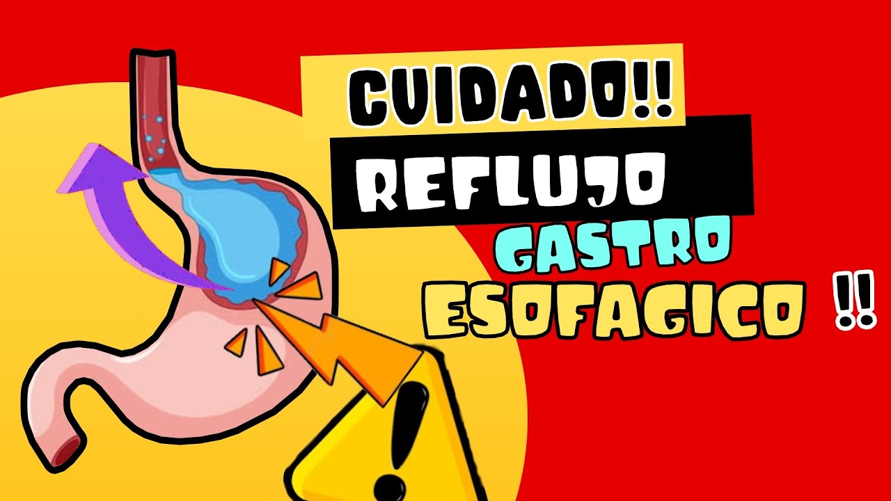 REFLUJO GASTROESOF&Aacute;GICO 🤢, UN CUADRO A TOMAR EN CUENTA PARA EL C&Aacute;NCER DE ES&Oacute;FAGO⚠️