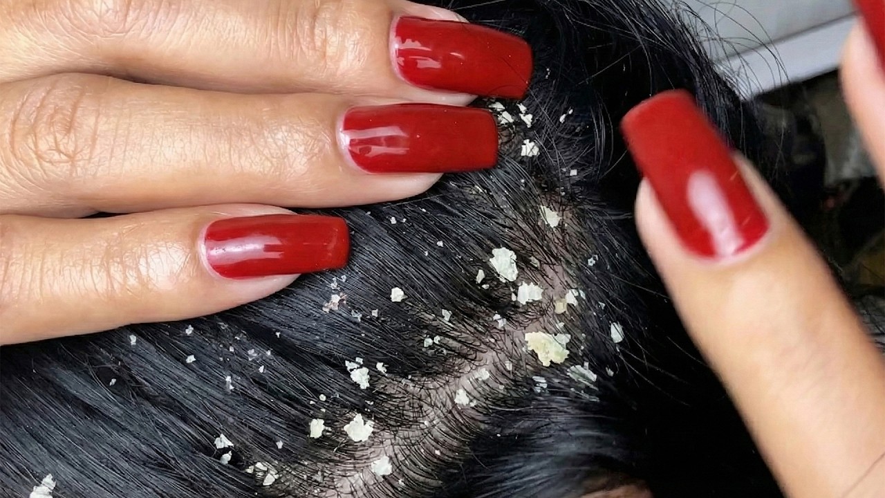 ASMR Satisfying Scalp Cleanse & Removal #0021