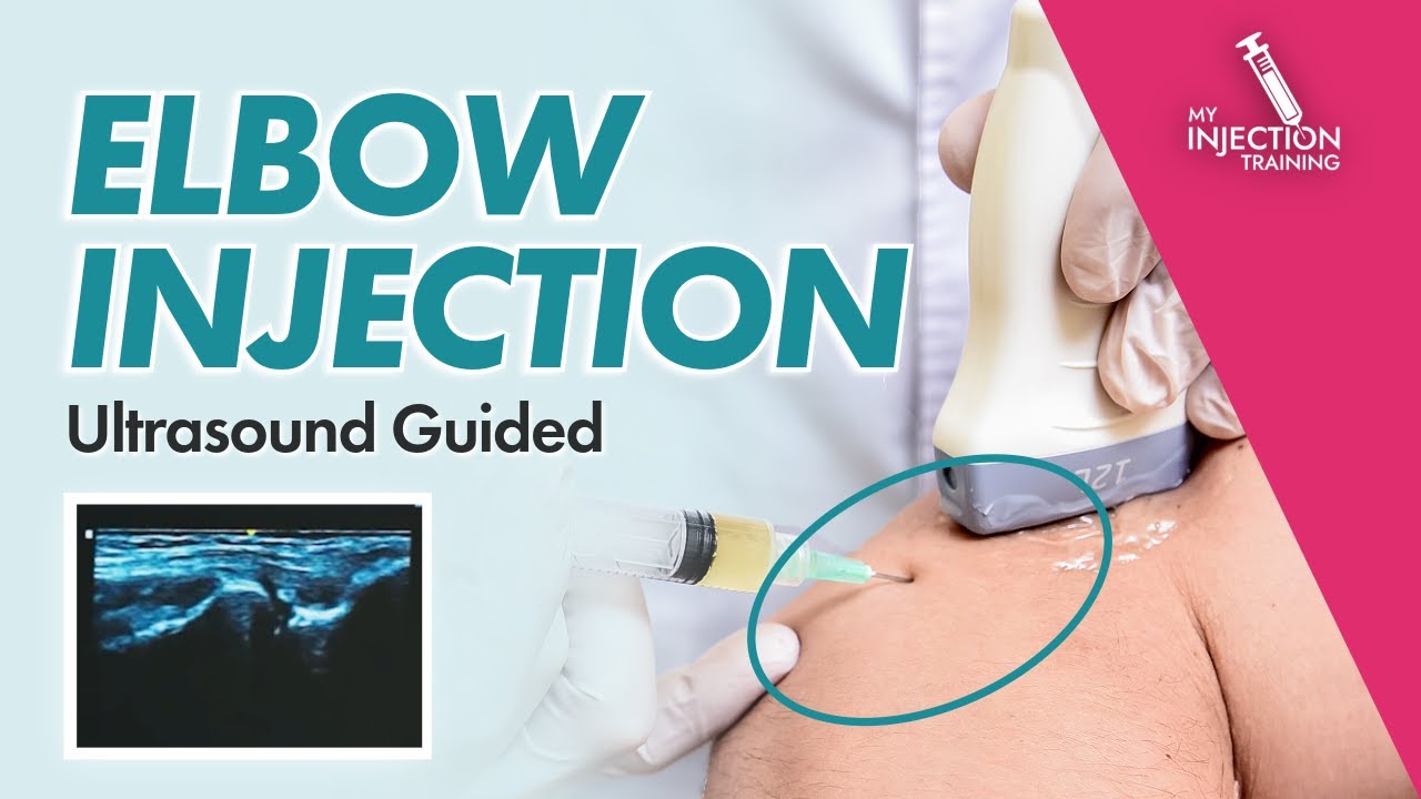 Ultrasound Guided Elbow Joint Injection (Step-by-Step)